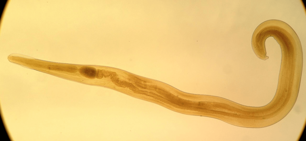 Pinworm-ը երեխաների շրջանում տարածված մակաբույծ է 
